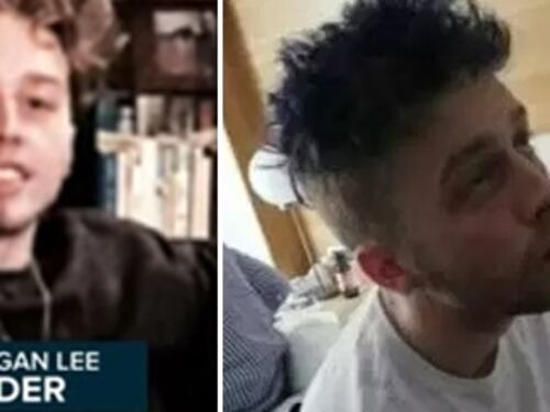 Lite a scuola, Elder provocò gravi danni cerebrali a un compagno
