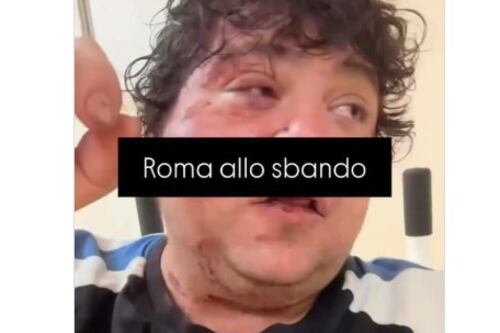 San Lorenzo, il rapper pestato dal branco e quelle sviolinate sulla (finta) integrazione