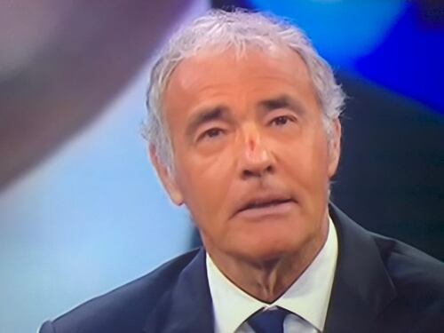 Giletti va in onda col naso tumefatto. Che succede a Non è l'Arena