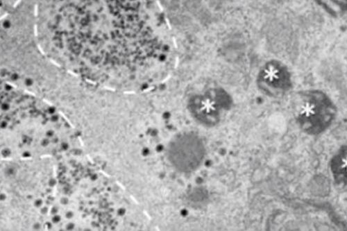 Yaravirus, isolato in Brasile un microrganismo con un Dna sconosciuto