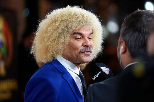 Valderrama: se la Colombia vince il Mondiale mi taglio i capelli